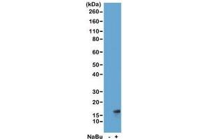 Western blot of acid extracts from HeLa cells untreated (-) or treated (+) with sodium butyrate using recombinant H3K27ac antibody at 1 ug/ml showed a band of Histone H3 acetylated at Lysine 27 in treated HeLa cells. (Recombinant Histone 3 抗体  (acLys27))