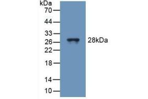 Detection of Recombinant TUBd, Mouse using Polyclonal Antibody to Tubulin Delta (TUBd) (TUBD1 抗体  (AA 236-455))