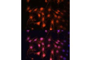Immunofluorescence analysis of C6 cells using E2F1 Polyclonal Antibody (ABIN3022839, ABIN3022840, ABIN3022841, ABIN1512843 and ABIN6219253) at dilution of 1:100 (40x lens). (E2F1 抗体)