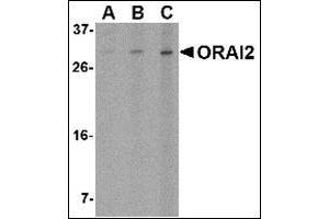 Western blot analysis of ORAI2 in Jurkat cell lysate with this product at (A) 1, (B) 2 and (C) 4 μg/ml. (ORAI2 抗体  (C-Term))