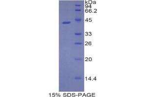 SDS-PAGE analysis of Rat Lipocalin 9 Protein.