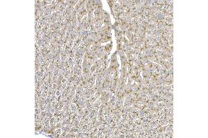 Immunohistochemistry of paraffin-embedded mouse liver using Niemann Pick C1 Rabbit mAb (ABIN7268911) at dilution of 1:50 (40x lens).