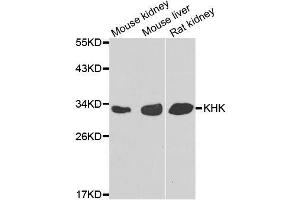 Western blot analysis of extracts of various cell lines, using KHK antibody. (Ketohexokinase 抗体  (AA 1-298))