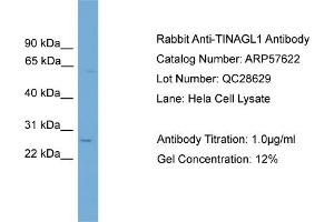 WB Suggested Anti-TINAGL1  Antibody Titration: 0. (TINAGL1 抗体  (Middle Region))