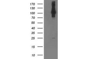 Western Blotting (WB) image for anti-NIMA (Never in Mitosis Gene A)- Related Kinase 9 (NEK9) antibody (ABIN1499687)