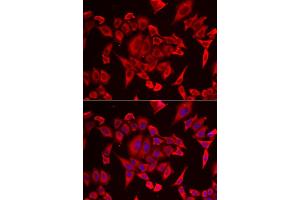 Immunofluorescence analysis of HeLa cell using SLC20A2 antibody. (SLC20A2 抗体)