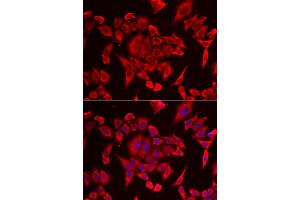 Immunofluorescence analysis of HeLa cell using SLC20A2 antibody. (SLC20A2 抗体)
