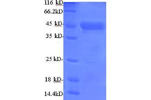 SDS-PAGE (SDS) image for Actin, alpha 1, Skeletal Muscle (ACTA1) (AA 3-377) protein (His tag) (ABIN5708995)