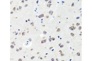 Immunohistochemistry of paraffin-embedded Mouse brain using DLG1 Polyclonal Antibody at dilution of 1:100 (40x lens). (DLG1 抗体)