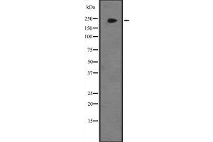 Western blot analysis of JMJD1B expression in Hela cell lysate,The lane on the left is treated with the antigen-specific peptide. (KDM3B 抗体  (Internal Region))