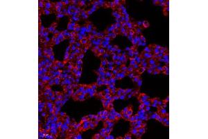 Immunofluorescence of paraffin embedded rat lung using MYL6 (ABIN7074734) at dilution of 1:650 (400x lens)