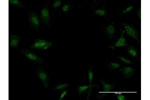 Immunofluorescence of monoclonal antibody to TWIST2 on HeLa cell. (TWIST2 抗体  (AA 1-160))