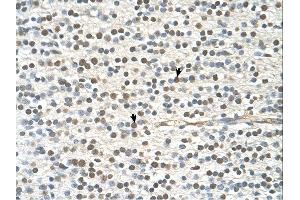 Immunohistochemistry (IHC) image for anti-GTPase Activating Protein and VPS9 Domains 1 (GAPVD1) (N-Term) antibody (ABIN2775423)