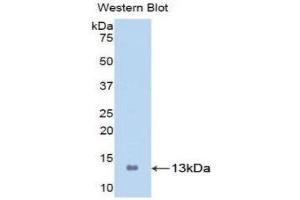 Western Blotting (WB) image for anti-S100 Calcium Binding Protein A8 (S100A8) (AA 1-93) antibody (ABIN1860487) (S100A8 抗体  (AA 1-93))