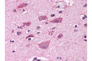 Immunohistochemical staining of Brain (Neurons and Glia) using anti- GRM7 antibody ABIN122320 (GRM7 抗体  (N-Term))