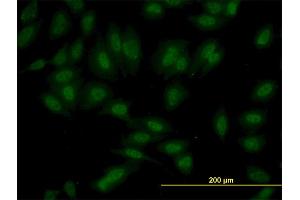 Immunofluorescence of monoclonal antibody to SET7 on HeLa cell. (SETD7 抗体  (AA 257-366))