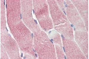 Human Skeletal Muscle (formalin-fixed, paraffin-embedded) stained with SIRT4 antibody ABIN337219 at 2. (SIRT4 抗体  (AA 302-314))