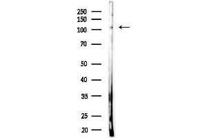 anti-Nuclear Factor Related To KappaB Binding Protein (NFRKB) (Internal Region) antibody