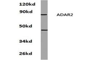 Image no. 1 for anti-Adenosine Deaminase, RNA-Specific, B1 (ADARB1) antibody (ABIN272206) (RED1 抗体)