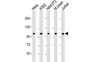 Western Blot at 1:2000 dilution Lane 1: Hela whole cell lysate Lane 2: K562 whole cell lysate Lane 3: NIH/3T3 whole cell lysate Lane 4: mouse brain lysate Lane 5: Jurkat whole cell lysate Lysates/proteins at 20 ug per lane. (DNM2 抗体  (AA 213-247))