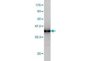 Western Blot detection against Immunogen (36. (SNF8 抗体  (AA 23-122))