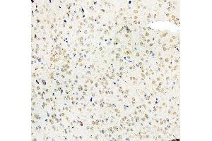 IHC analysis of MID1 using anti-MID1 antibody (ABIN6719400).