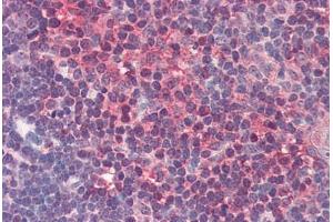 Human Thymus (formalin-fixed, paraffin-embedded) stained with PGDS antibody ABIN337149 at 10 ug/ml followed by biotinylated secondary antibody, alkaline phosphatase-streptavidin and chromogen. (HPGDS 抗体)