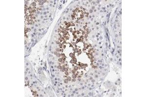 Immunohistochemical staining (Formalin-fixed paraffin-embedded sections) of human testis with FSCB polyclonal antibody  shows strong cytoplasmic positivity in cells in seminiferous ducts at 1:200-1:500 dilution.