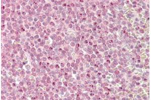 Image no. 1 for anti-Myeloid/lymphoid Or Mixed-Lineage Leukemia 2 (MLL2) (AA 2-14) antibody (ABIN1494780) (MLL2 抗体  (AA 2-14))