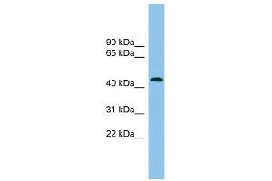 ACTR1B antibody used at 1 ug/ml to detect target protein. (ACTR1B 抗体)