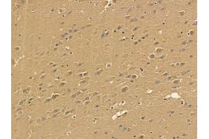 PMPCA Mouse Monoclonal Antibody at 1/100 staining mouse brain tissue by IHC-P. (PMPCA 抗体)