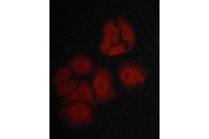 ABIN6268647 staining MCF-7 cells by ICC/IF.