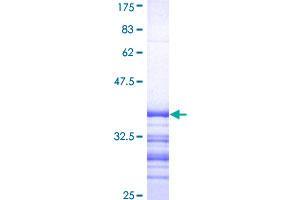 ATP7B Protein (AA 1372-1465) (GST tag)