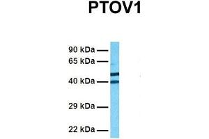 Host:  Rabbit  Target Name:  PTOV1  Sample Tissue:  Human 293T  Antibody Dilution:  1. (PTOV1 抗体  (N-Term))