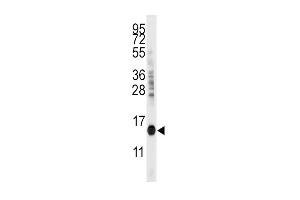 Western blot analysis of anti-CDA Antibody in mouse kidney tissue lysates (35ug/lane) (CDA 抗体  (C-Term))