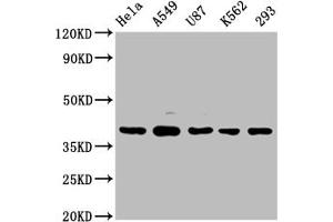 Western Blot Positive WB detected in: Hela whole cell lysate, A549 whole cell lysate, U87 whole cell lysate, K562 whole cell lysate, 293 whole cell lysate All lanes: PIH1D1 antibody at 1:2000 Secondary Goat polyclonal to rabbit IgG at 1/50000 dilution Predicted band size: 33, 20, 22 kDa Observed band size: 39 kDa (PIH1D1 抗体  (AA 1-290))