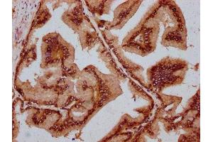 IHC image of ABIN7159037 diluted at 1:800 and staining in paraffin-embedded human prostate tissue performed on a Leica BondTM system. (MAML2 抗体  (AA 347-506))