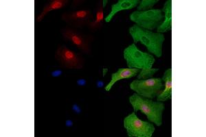 ABIN6258901 and ABIN6273724 staining  cells by IF/ICC. (KLF14 抗体  (C-Term))