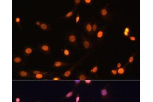 Immunofluorescence analysis of C6 cells using WT1 Polyclonal Antibody at dilution of 1:100. (WT1 抗体)