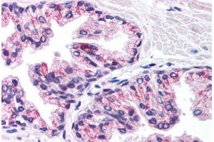 Human Prostate (formalin-fixed, paraffin-embedded) stained with PHKG2 antibody ABIN214802 at 5 ug/ml followed by biotinylated goat anti-rabbit IgG secondary antibody ABIN481713, alkaline phosphatase-streptavidin and chromogen. (PHKG2 抗体  (N-Term))