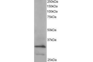 Western Blotting (WB) image for anti-Actin Related Protein 2/3 Complex, Subunit 2, 34kDa (ARPC2) (C-Term) antibody (ABIN2465173) (ARPC2 抗体  (C-Term))