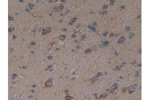 Immunohistochemistry (IHC) image for anti-Sonic Hedgehog (SHH) (AA 36-193) antibody (ABIN7434161)