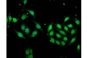 Immunofluorescence staining of A549 cells with ABIN7168378 at 1:166, counter-stained with DAPI. (MSI1 抗体  (AA 221-347))