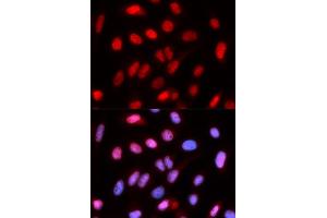 Immunofluorescence analysis of U2OS cells using RFC4 antibody (ABIN5973195). (RFC4 抗体)