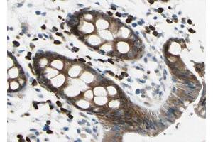 ABIN6267020 at 1/100 staining human Rectum tissue sections by IHC-P.