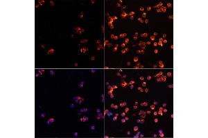 Immunofluorescence analysis of Jurkat cells using CASP3 antibody (ABIN6292881) at dilution of 1:100. (Caspase 3 抗体)