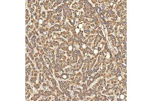 IHC analysis of Citrin/SLC25A13 using anti-Citrin/SLC25A13 antibody (ABIN7599512). (slc25a13 抗体  (AA 1-643))