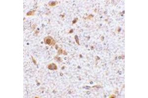 Immunohistochemistry of TSLP in Mouse brain tissue with AP30965PU-N TSLP antibody at 2. (Thymic Stromal Lymphopoietin 抗体  (Center))