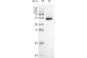 WB analysis of Human C-Nanodisc with anti-Flag monoclonal antibody at 1/5000 dilution, followed by Goat Anti-Rabbit IgG HRP at 1/5000 dilution (CXCR3 蛋白)