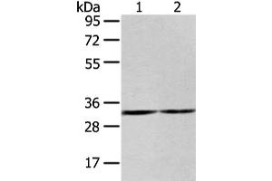 Gel: 8 % SDS-PAGE, Lysate: 40 μg, Lane 1-2: 231 and K562 cell, Primary antibody: ABIN7193107(ZNF146 Antibody) at dilution 1/200 dilution, Secondary antibody: Goat anti rabbit IgG at 1/8000 dilution, Exposure time: 20 seconds